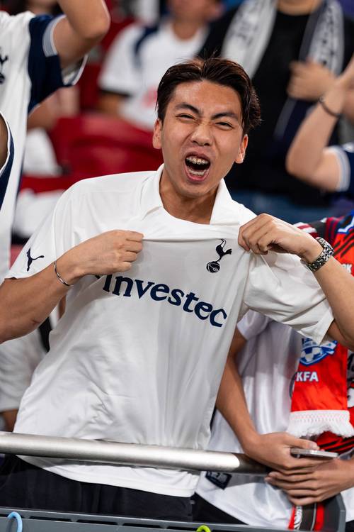 基米希能否出战斯洛伐克？纳格尔斯曼：我持谨慎怀疑态度